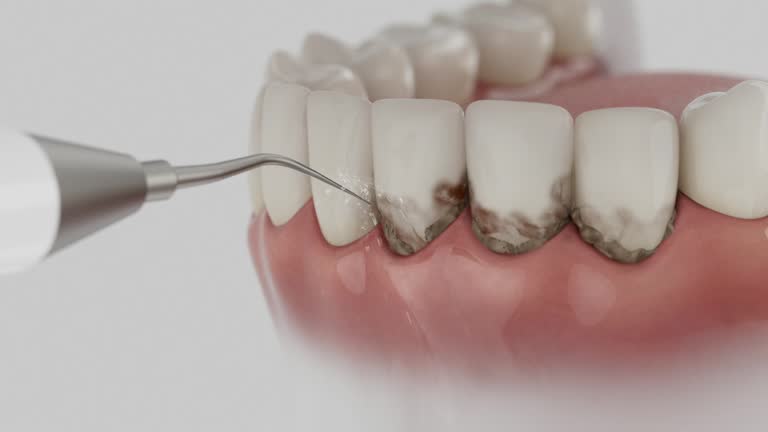 Trusted Teeth Cleaning And Checkup service in Mount Holly Springs, PA - Dentist Open Now
